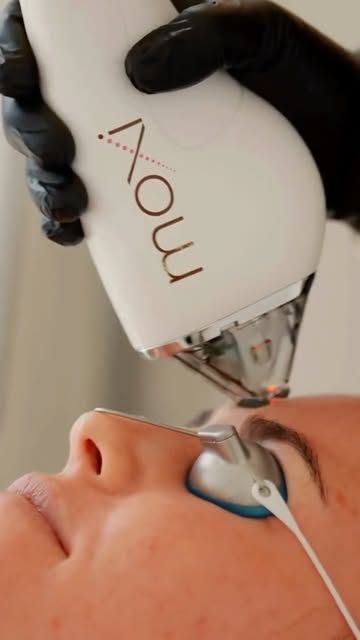 Natural-looking MOXI results at Wellface Wimbledon