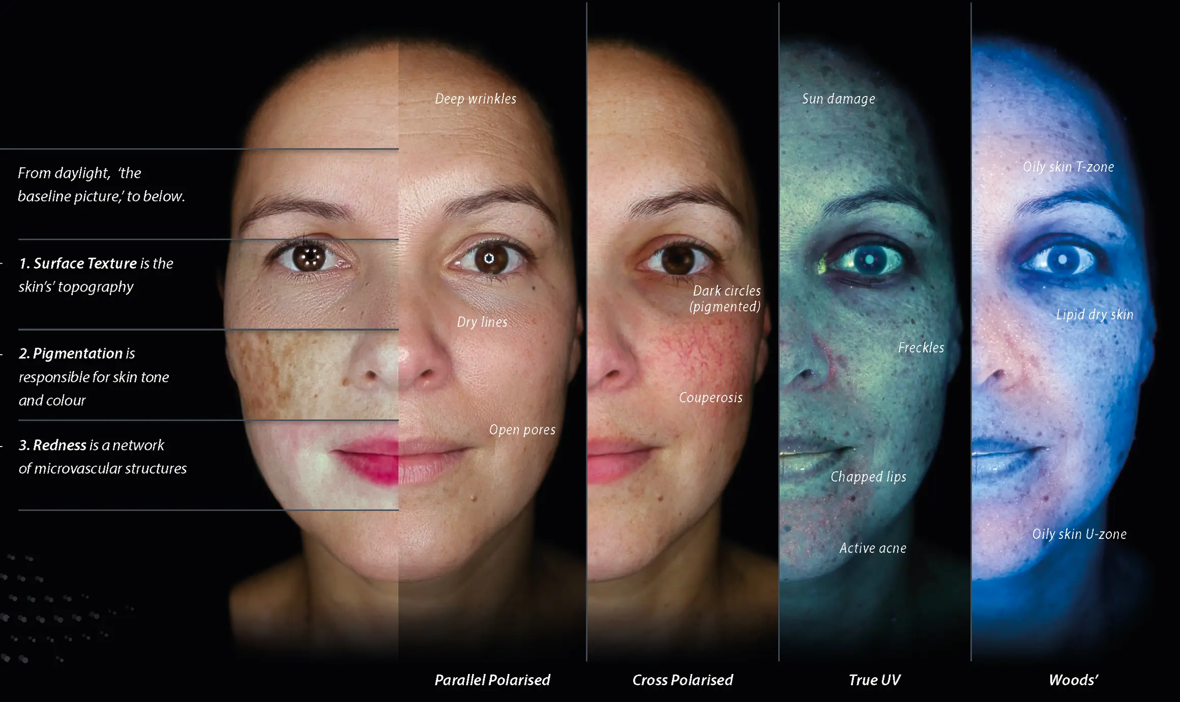 Skin scan results reviewed on screen