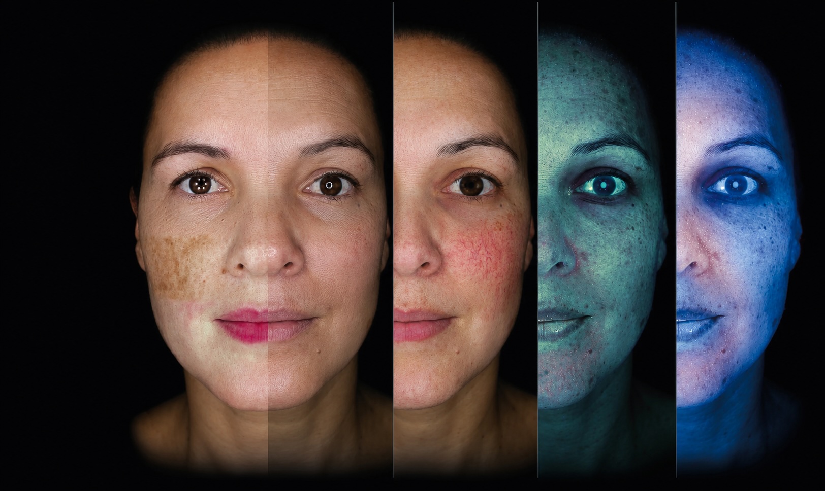 The Wellface Skin Scan revealing skin texture, pigmentation and redness