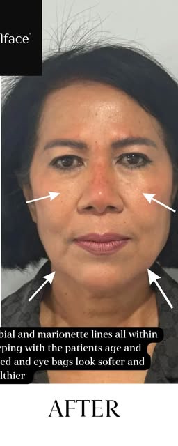 After treatment at Wellface Cobham