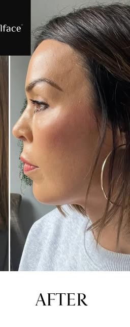 After treatment at Wellface Cobham