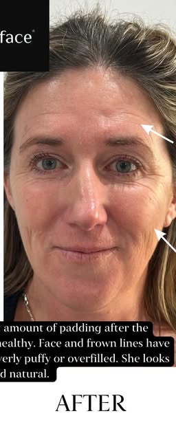 After treatment at Wellface Cobham