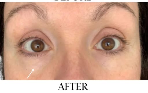 After treatment at Wellface Cobham