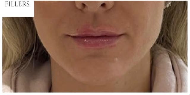 After treatment at Wellface Cobham
