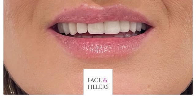 After treatment at Wellface Cobham