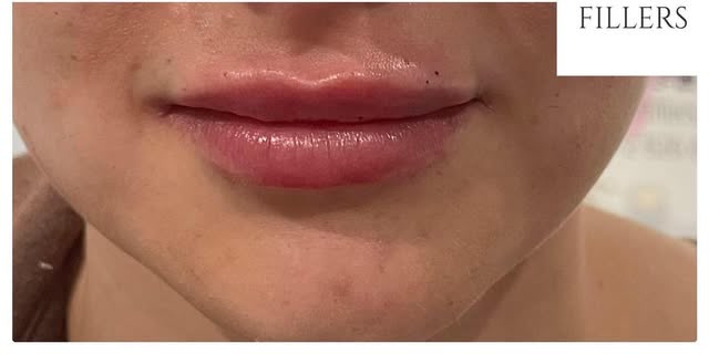 After treatment at Wellface Cobham