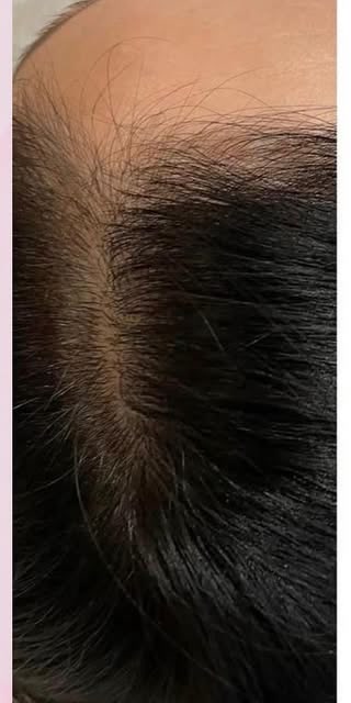 After treatment at Wellface Cobham