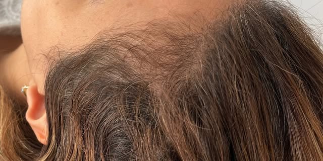 After treatment at Wellface Cobham
