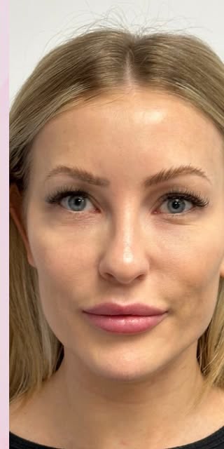 After treatment at Wellface Cobham