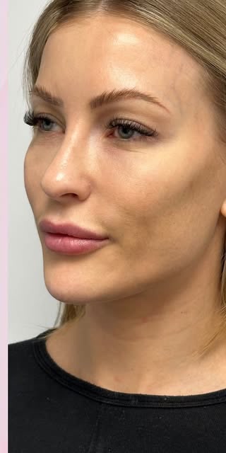 After treatment at Wellface Cobham