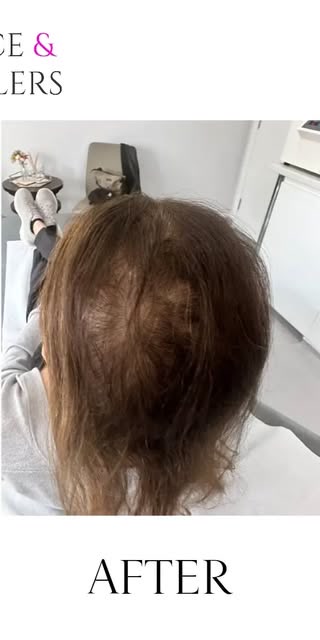 After treatment at Wellface Cobham