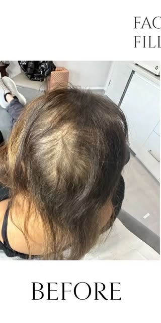 Before treatment at Wellface Cobham