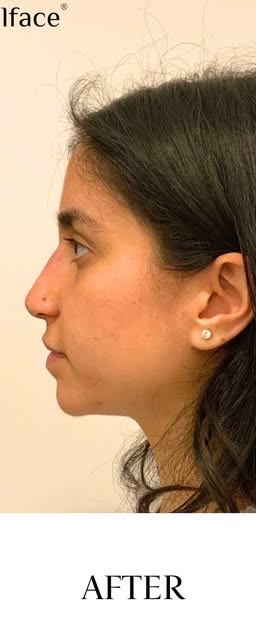 After treatment at Wellface Cobham