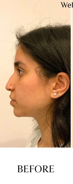 Before treatment at Wellface Cobham