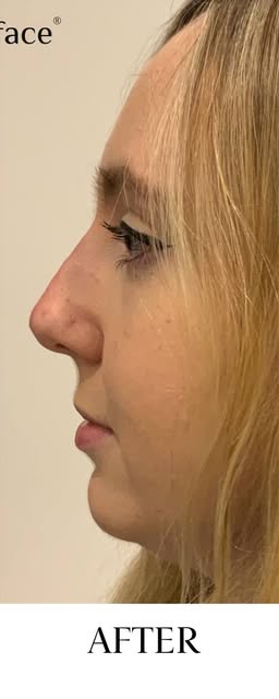 After treatment at Wellface Cobham