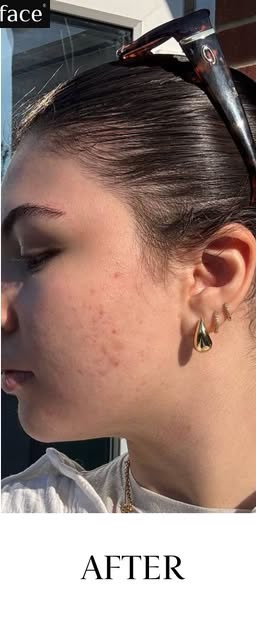 After treatment at Wellface Cobham