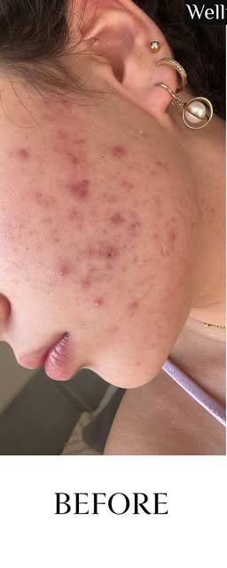 Before treatment at Wellface Cobham