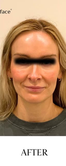 After treatment at Wellface Cobham