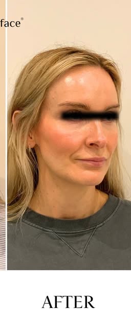 After treatment at Wellface Cobham