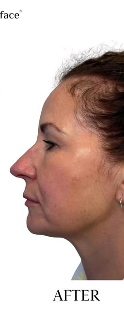 After treatment at Wellface Cobham