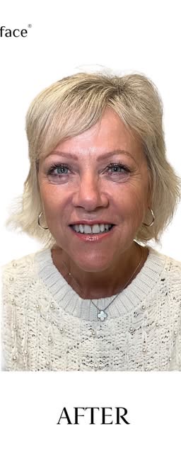 After treatment at Wellface Cobham