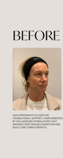 Before treatment at Wellface Cobham