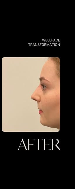 After treatment at Wellface Cobham