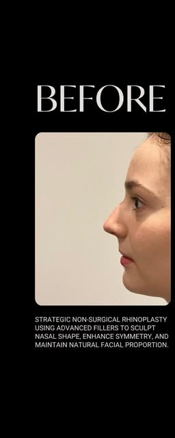 Before treatment at Wellface Cobham