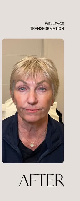 After treatment at Wellface Cobham