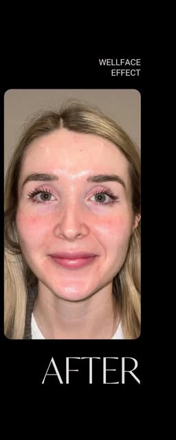 After treatment at Wellface Cobham
