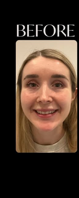 Before treatment at Wellface Cobham