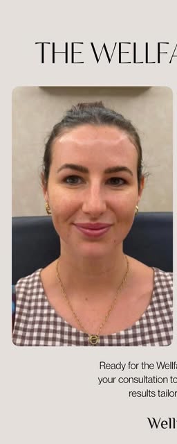 Before treatment at Wellface Cobham