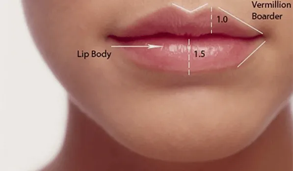 Softly enhanced, natural-looking lips at Wellface Esher