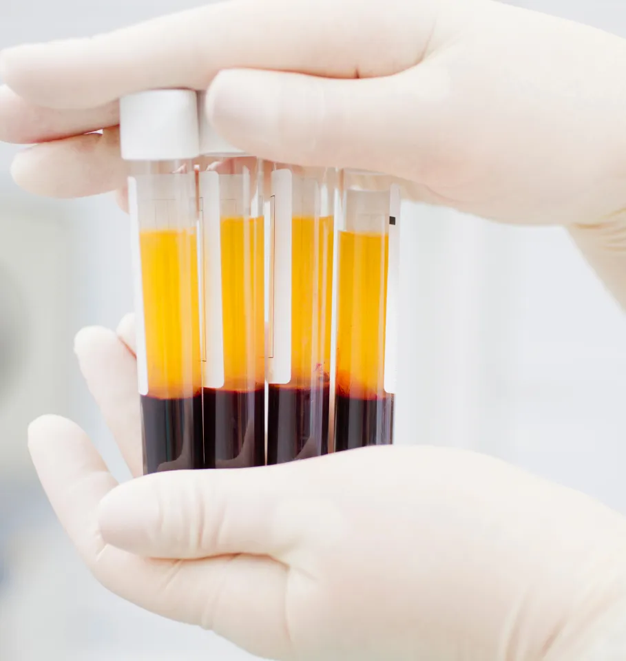 Exosome therapy at Wellface Cobham