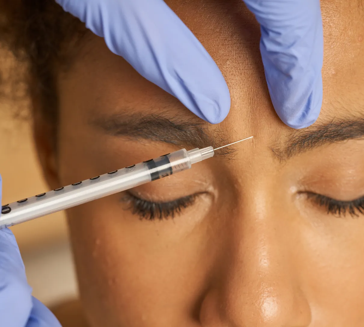 A doctor placing a precise, low-dose injection at Wellface Cobham