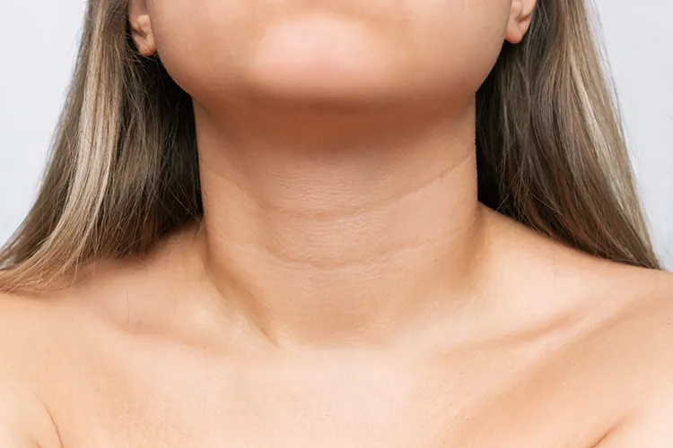A relaxed jawline and smooth profile, the goal of bruxism treatment at Wellface Wimbledon