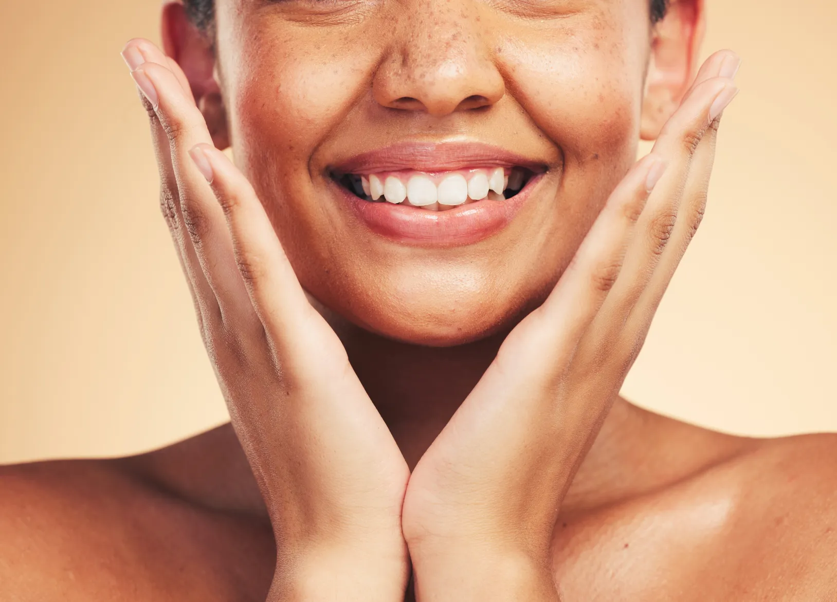 Natural-looking gummy smile treatment results at Wellface Cobham