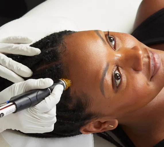 Hydrafacial Keravive scalp treatment at Wellface