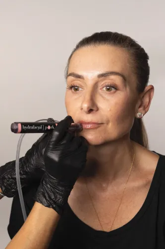 Hydrafacial treatment at Wellface Wimbledon