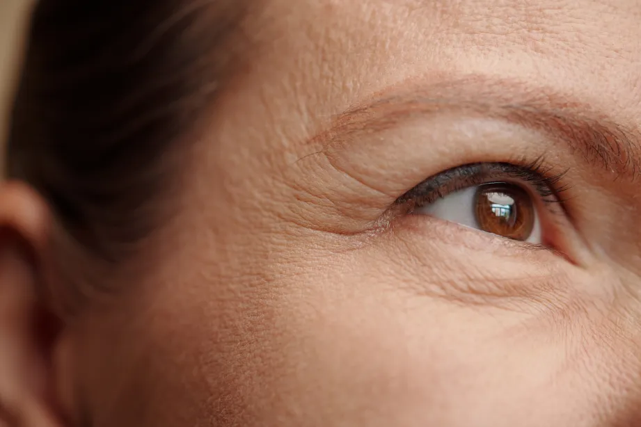 Anti-wrinkle treatment at Wellface