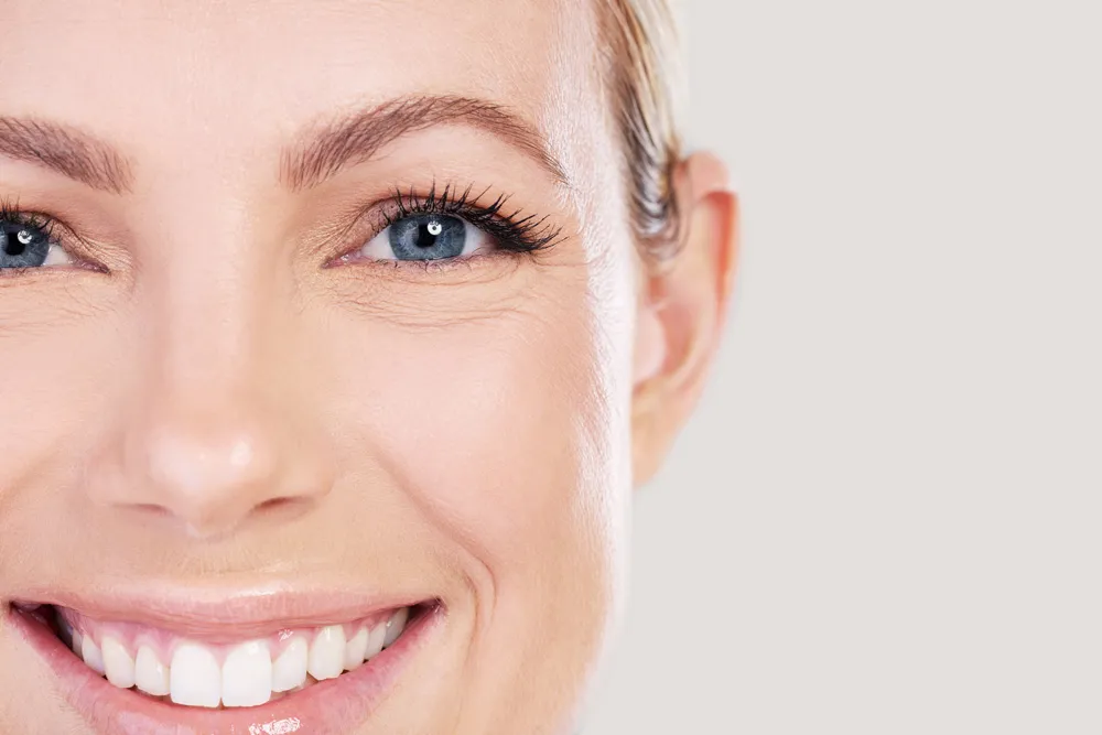 Smile lines filler treatment at Wellface
