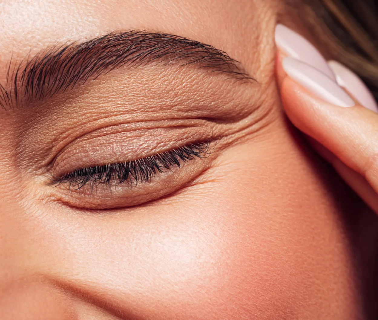 Natural-looking tear trough filler results at Wellface Cobham
