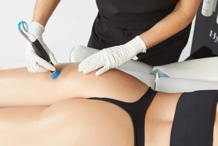 Body contouring
