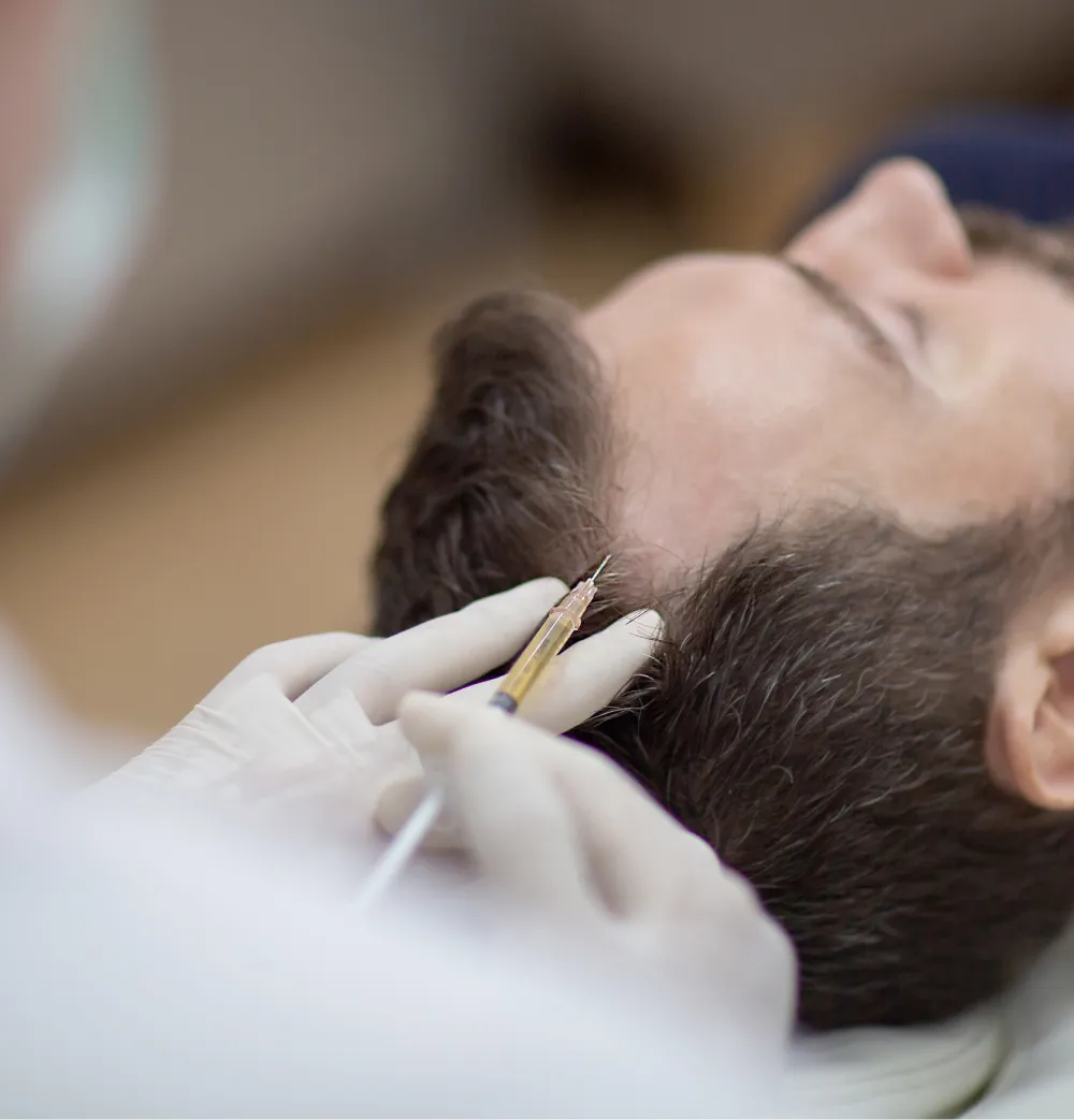 Natural-looking PRP hair growth results at Wellface Cobham
