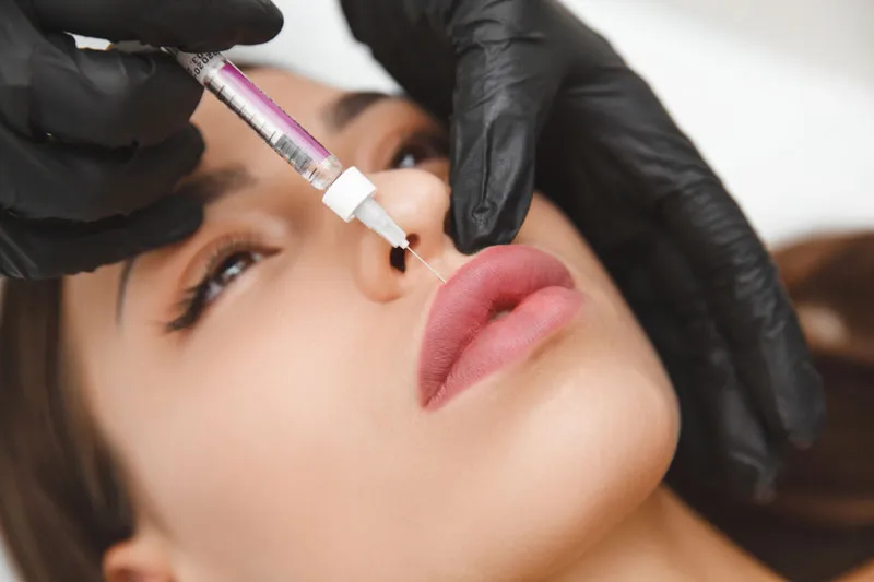 Lip filler being shaped with precision at Wellface Esher