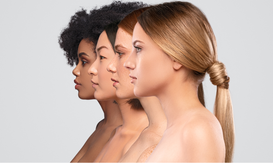 Natural-looking Profhilo results at Wellface Cobham