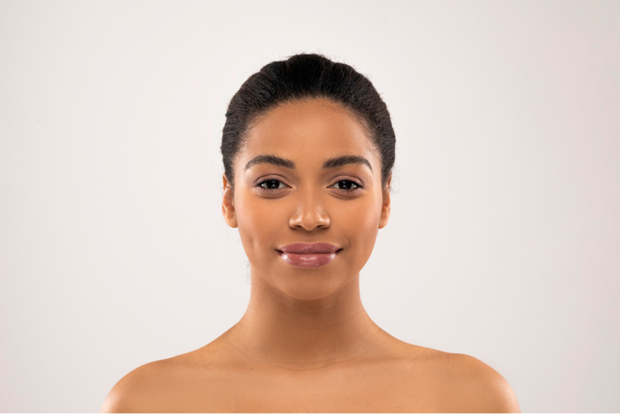 Glowing, hydrated skin after PROFHILO at Wellface Wimbledon