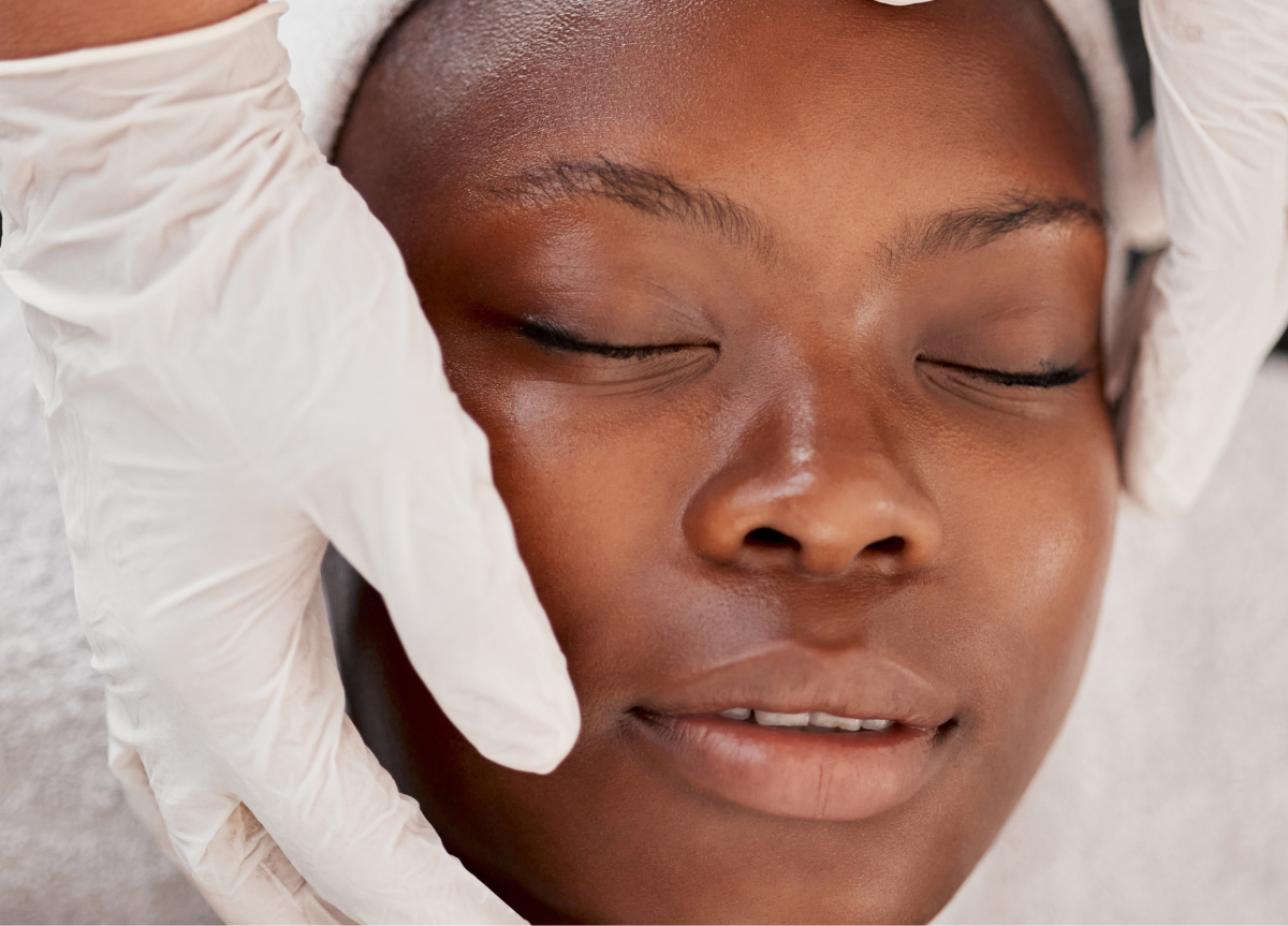 Natural-looking skin peel results at Wellface Cobham