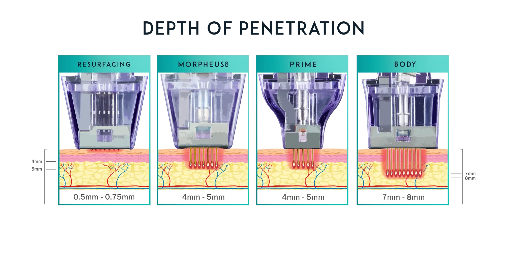 Morpheus8 treatment depths across face and body