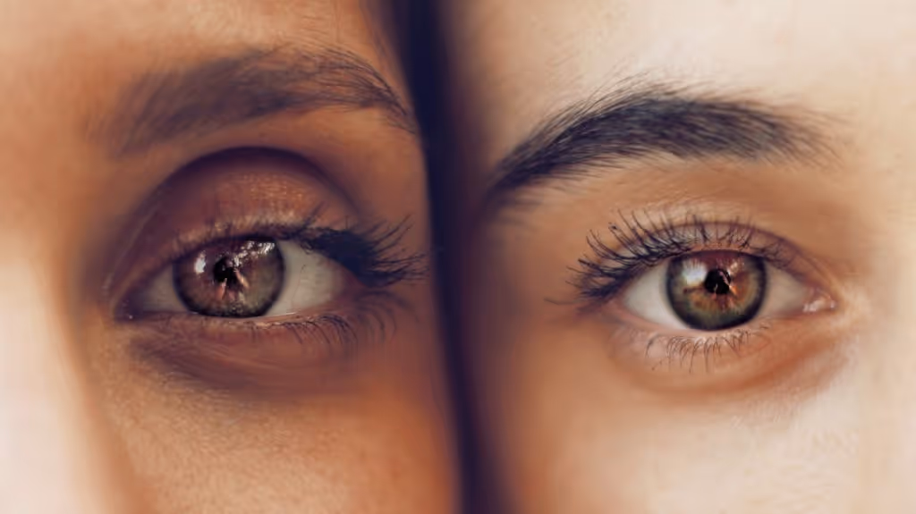 Tired eyes treatment at Wellface